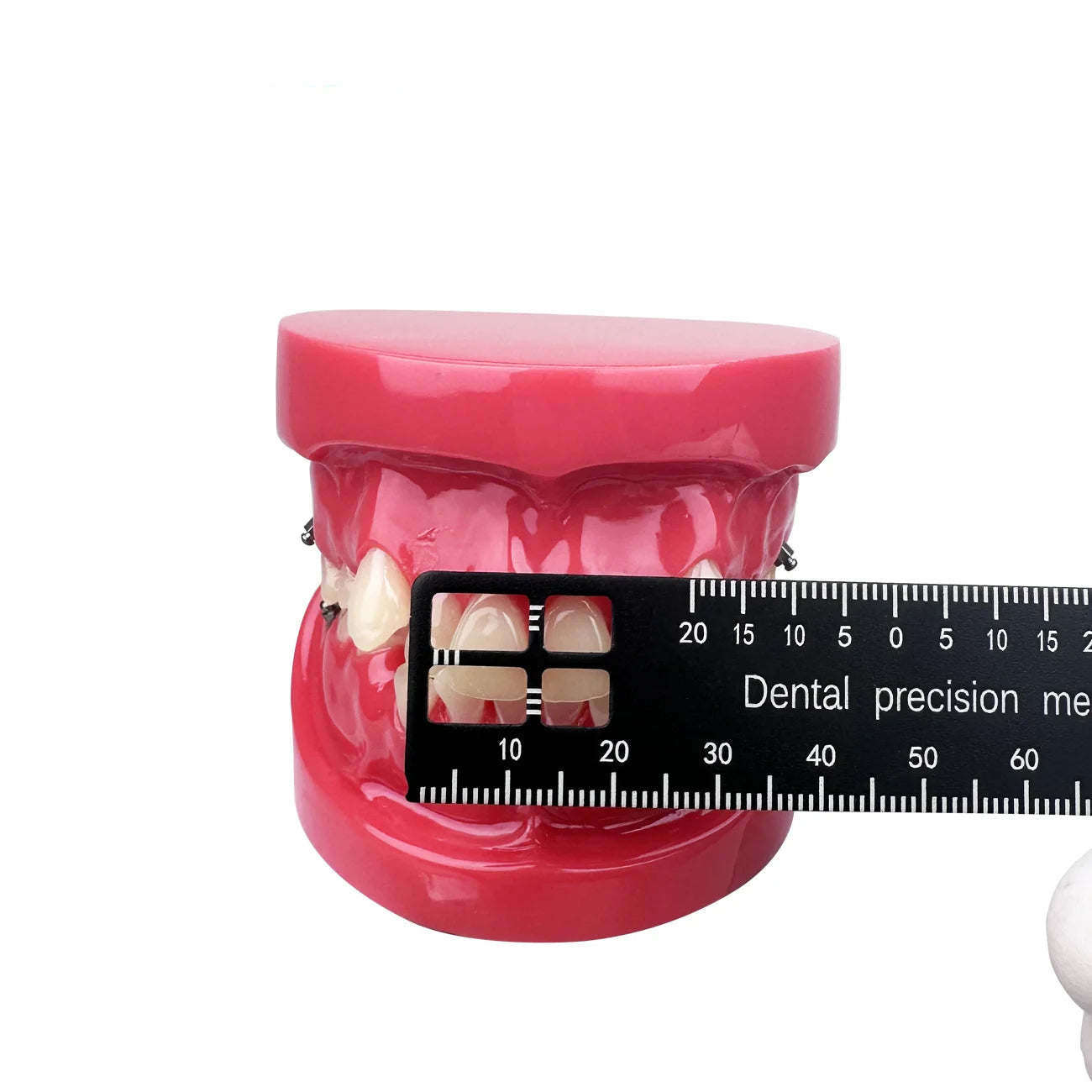 Dental Precision Measuring Ruler