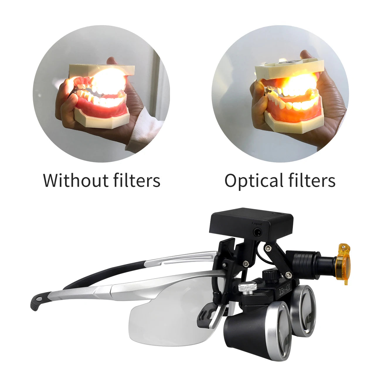 Dental Magnification Binocular Loupes with Wireless 5W Headlamp