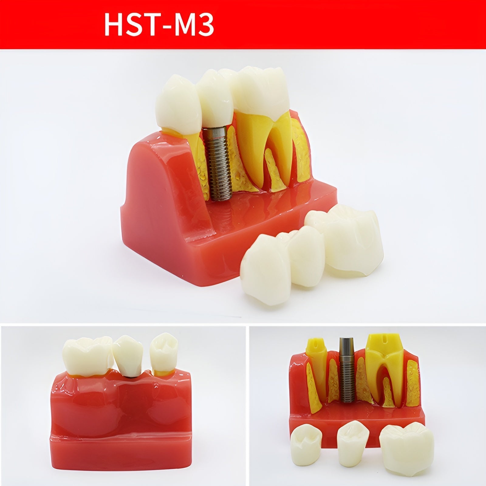 Dental Teaching & Communication Models