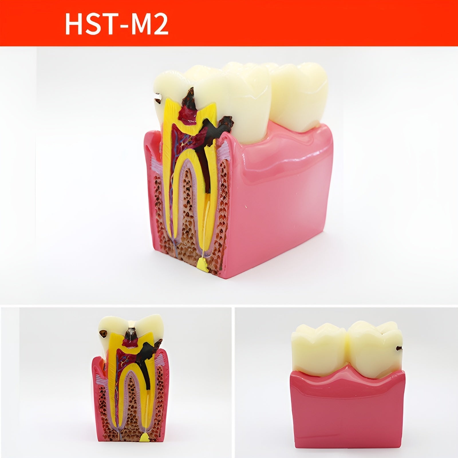 Dental Teaching & Communication Models