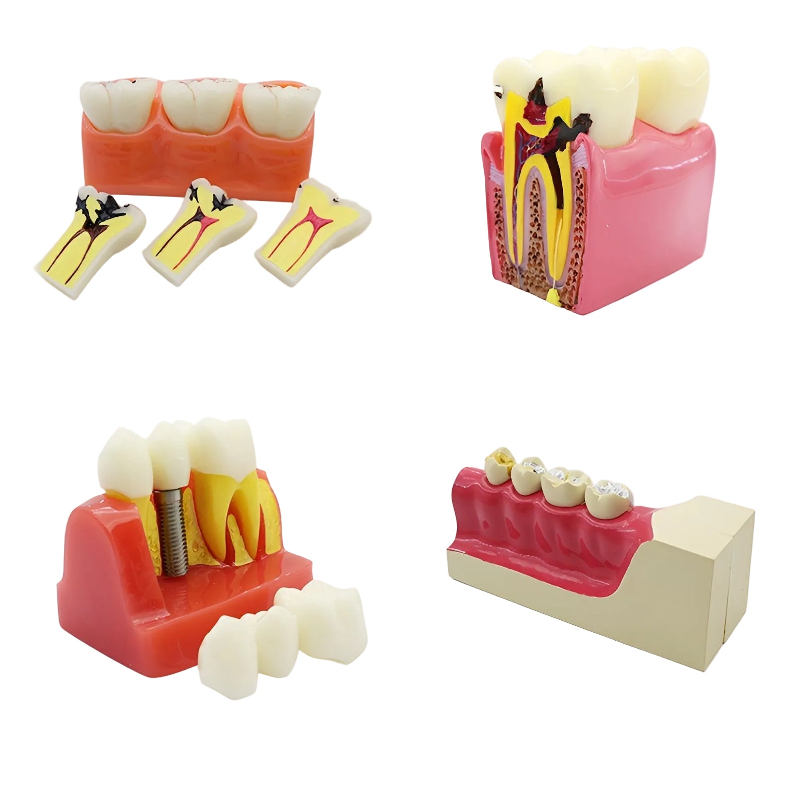 Dental Teaching & Communication Models