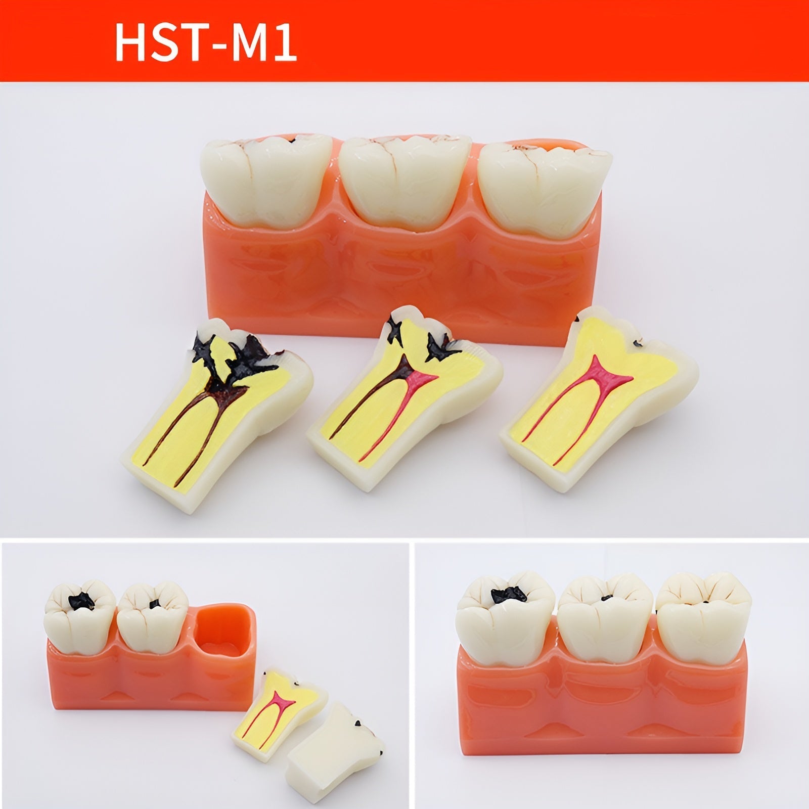 Dental Teaching & Communication Models