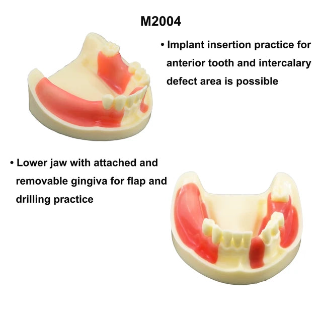 Planets Dental Implant Practice Models