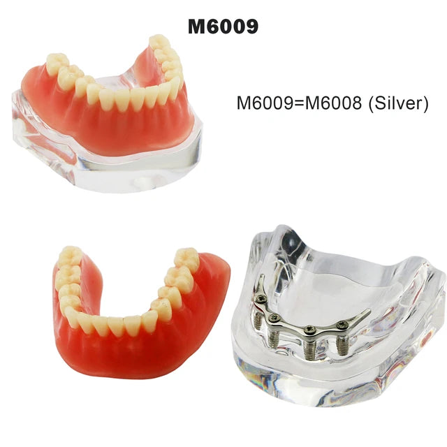 Planets Dental Implant Practice Models