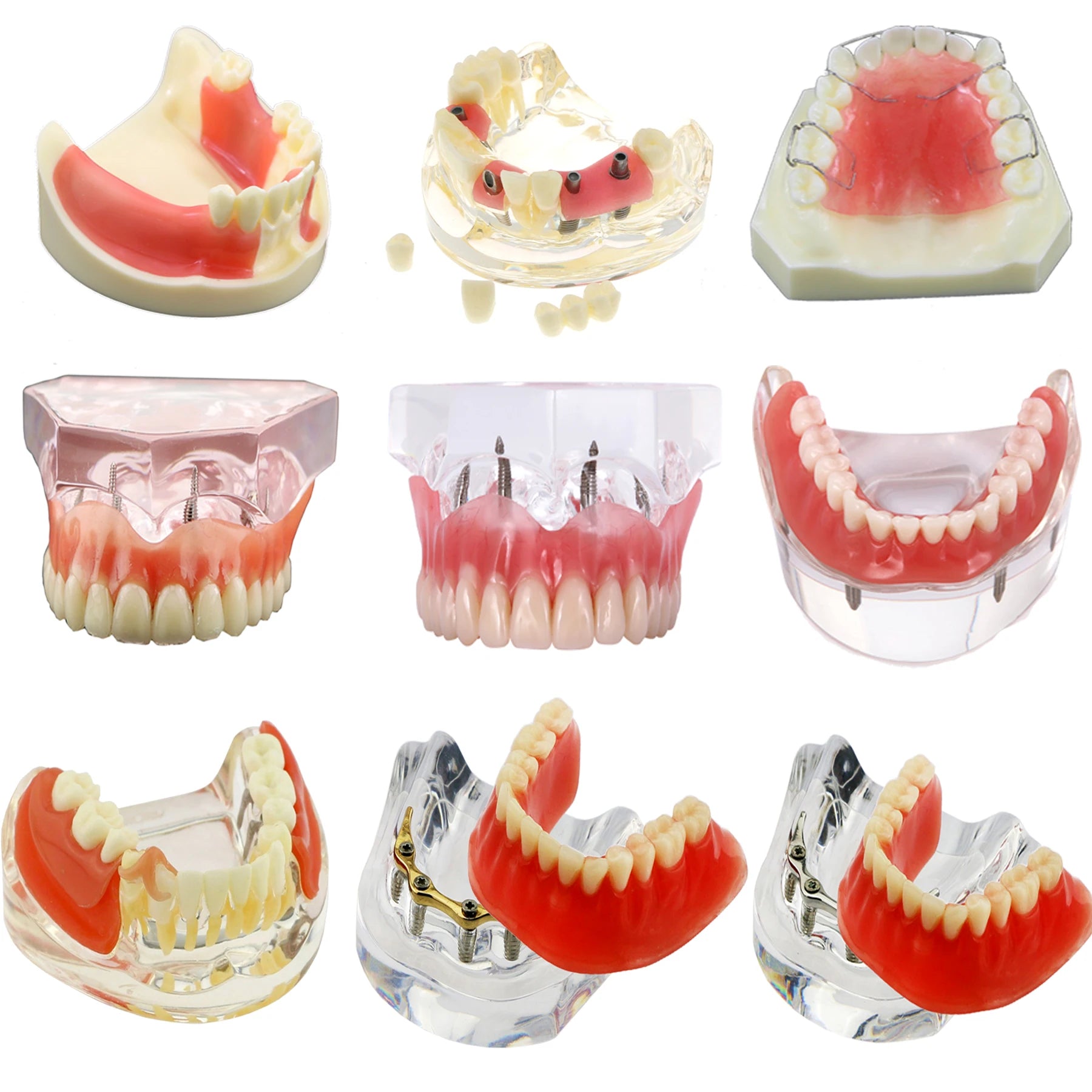 Planets Dental Implant Practice Models