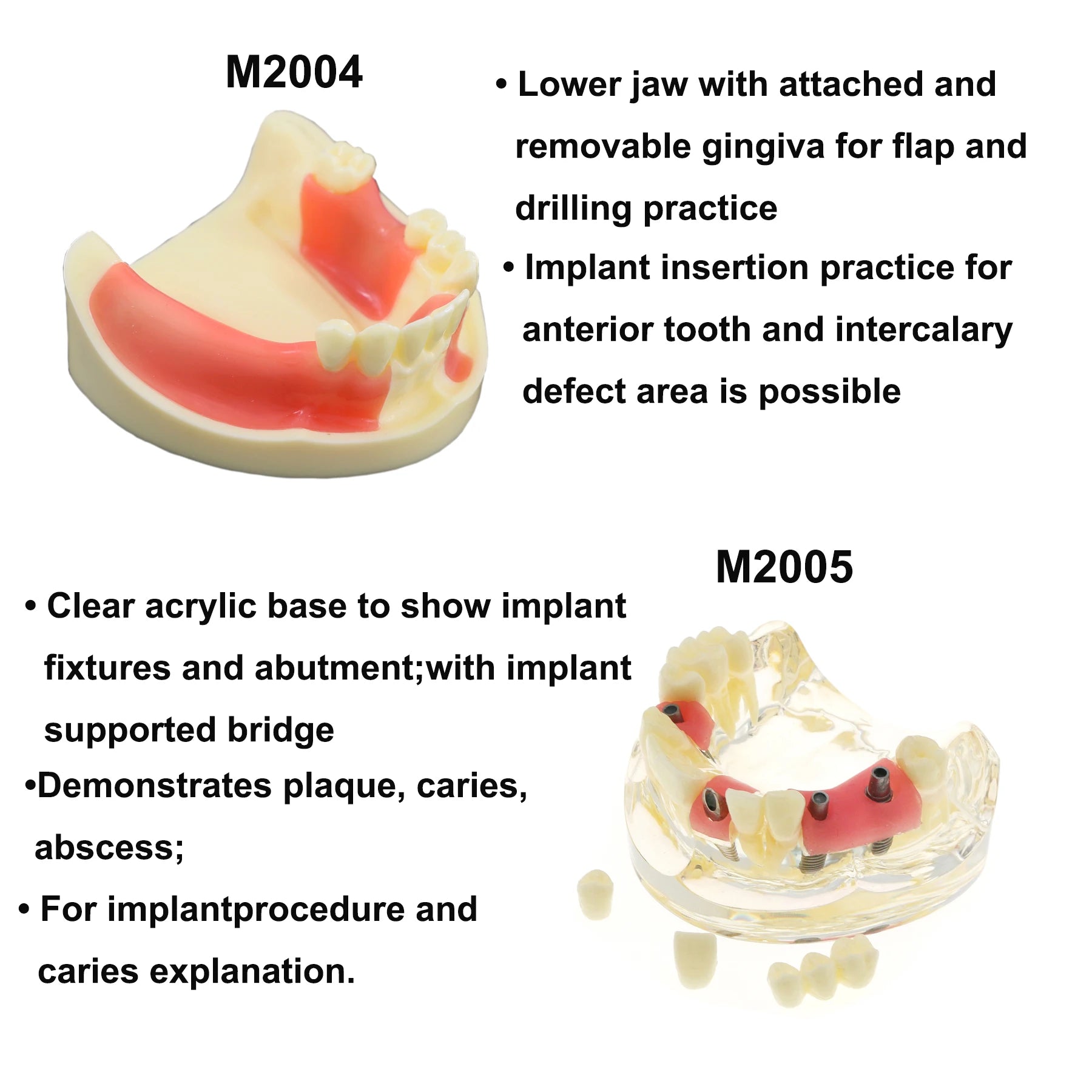 Planets Dental Implant Practice Models