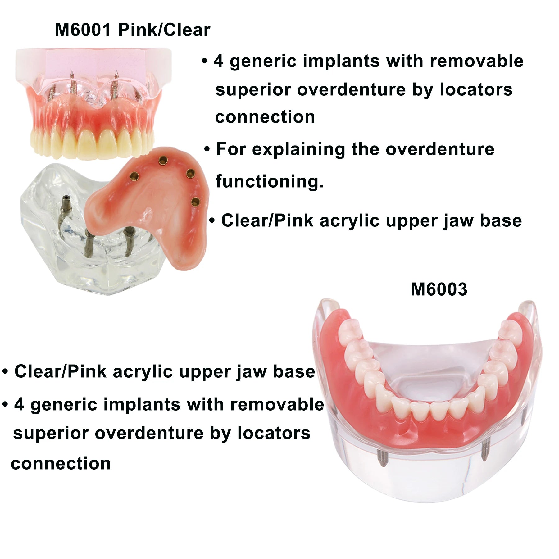 Planets Dental Implant Practice Models