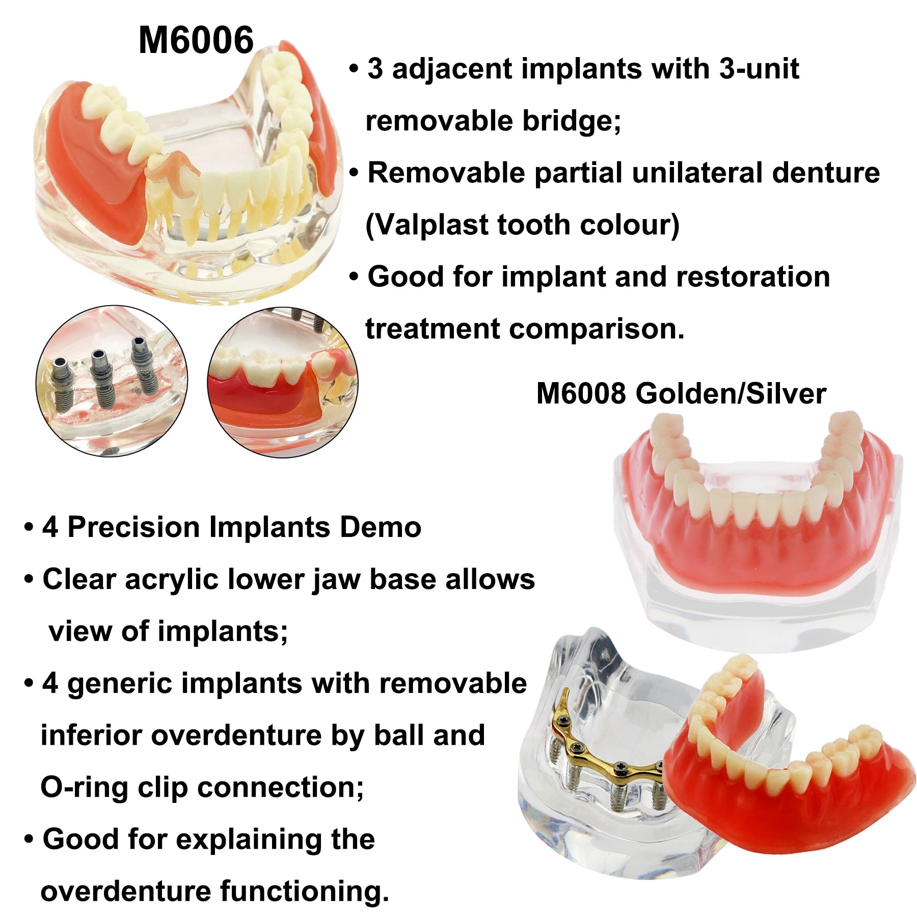 Planets Dental Implant Practice Models