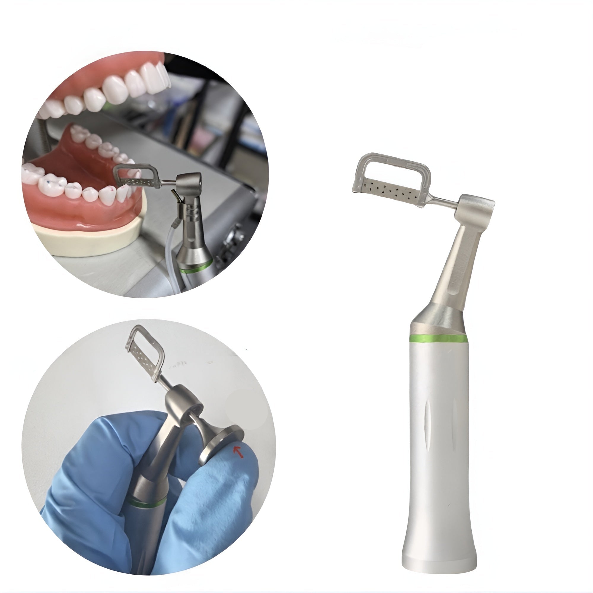 Interproximal Enamel Reduction Kit