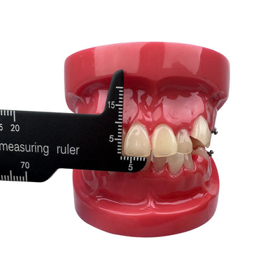 Dental Precision Measuring Ruler