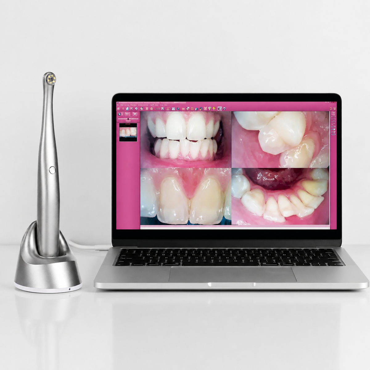 Kabellose Intraoralkamera 5 MP 2K HD — 5G-WLAN, 6 LEDs, 30 FPS, IPX5, für iOS, Android und Windows