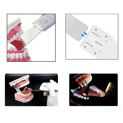 Anti-Fog Mirror for Dental Photography