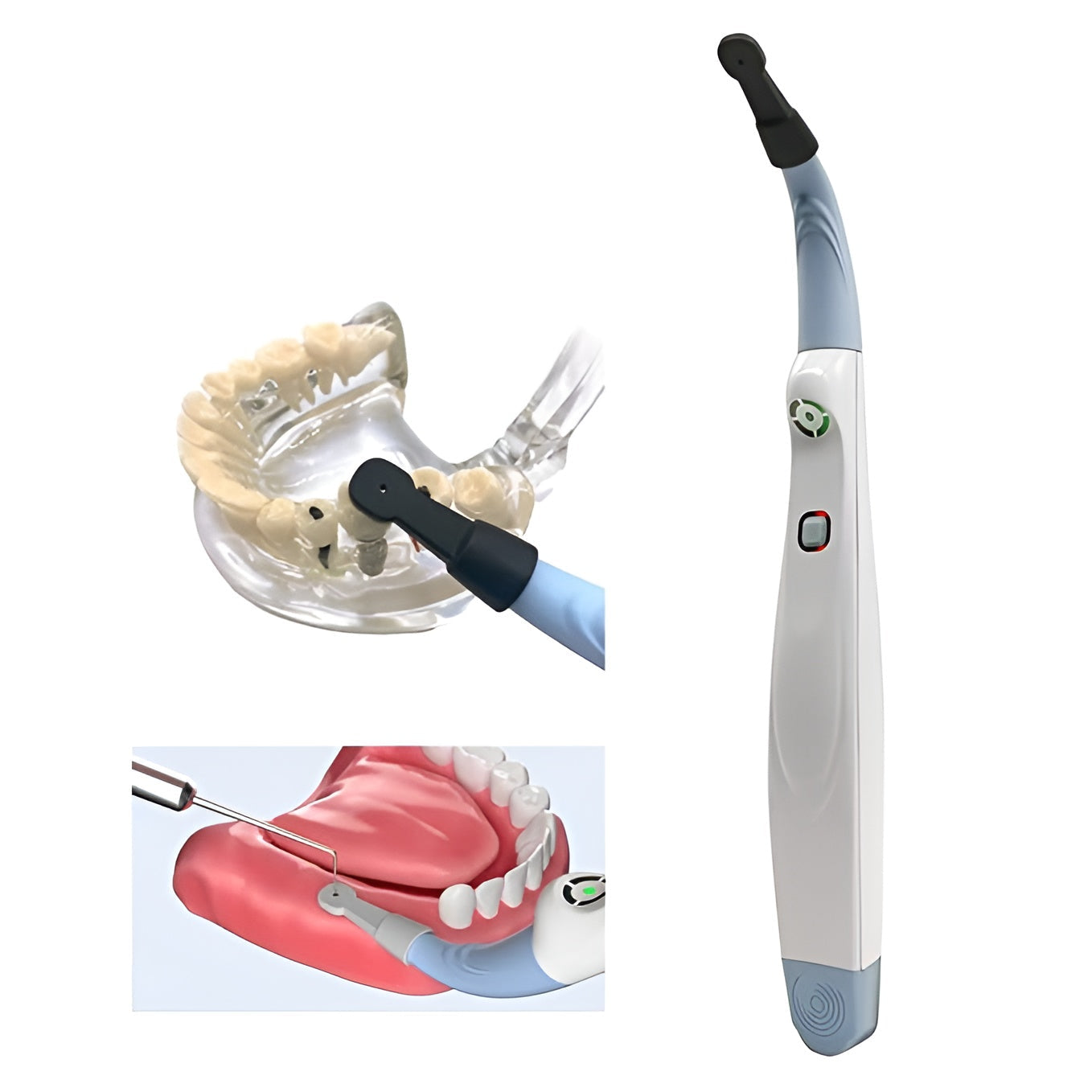 Easyinsmile Dental Implant Locator
