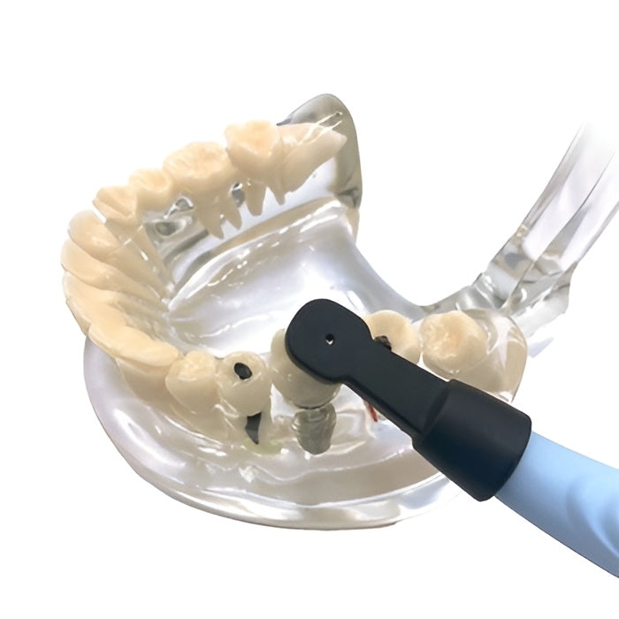 Easyinsmile Dental Implant Locator