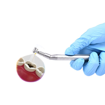 Dental Micro Intra-Oral Camera System