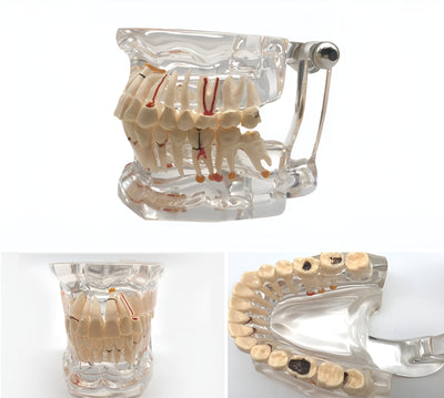 Dental Education Model (Patholigical)