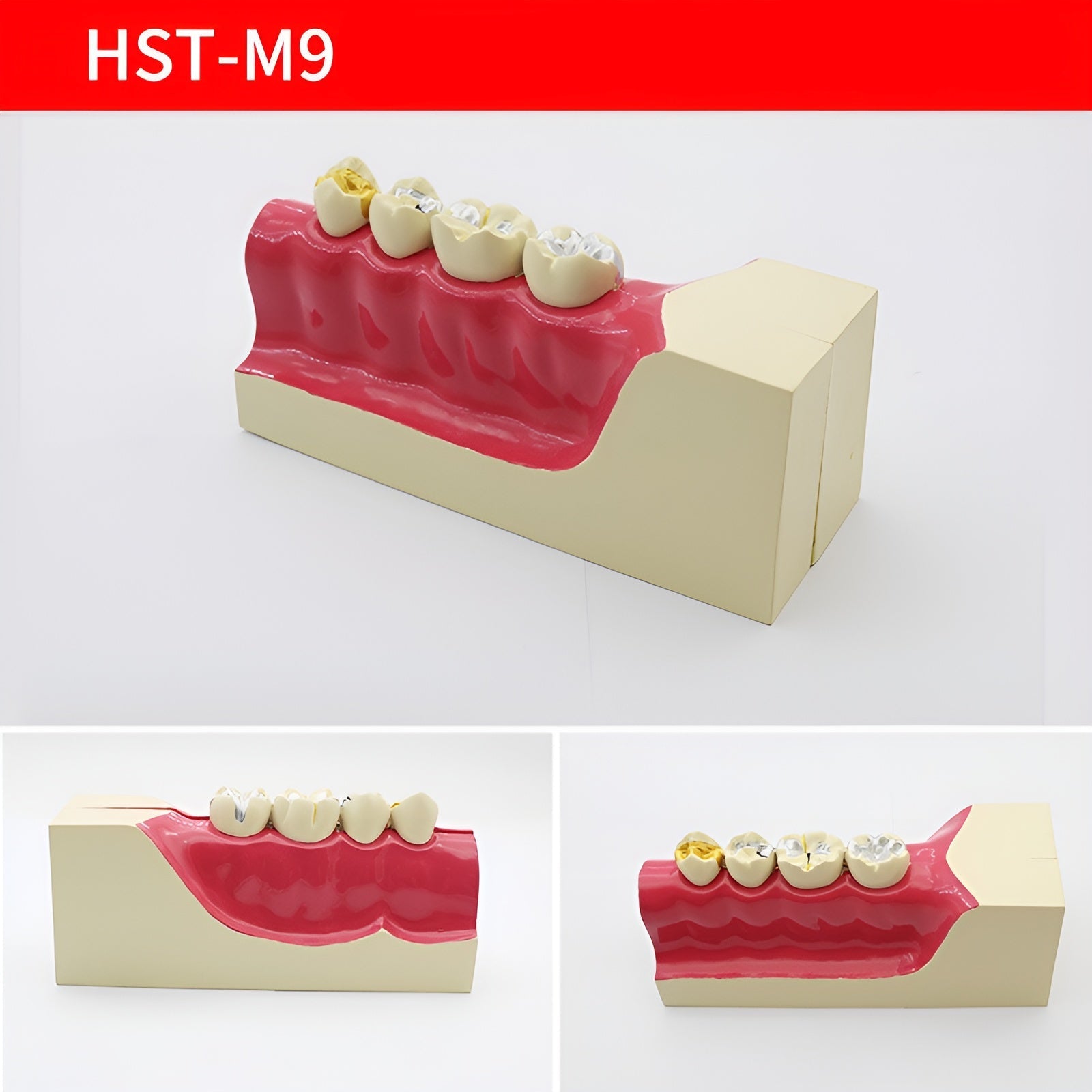 Dental Teaching & Communication Models