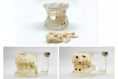 Dental Education Model (Patholigical)